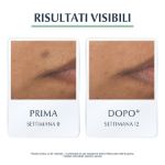 Eucerin DermoPurifyer Oil Control Siero tripla azione Anti-macchie post acne 40ml