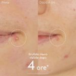 Caudalie Vinopure soluzione salicilica stop brufoli 15ml