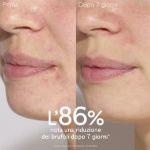 Caudalie Vinopure Siero all'Acido Salicilico Anti-imperfezioni 30ml