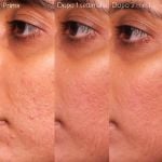 Caudalie Vinopure Siero all'Acido Salicilico Anti-imperfezioni 30ml
