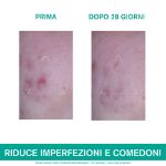 Uriage Hyseac 3-regul+ Trattamento Globale anti-imperfezioni 40ml - ZERO SPRECHI 