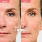 Remescar Lifting Viso Istant 40 ml