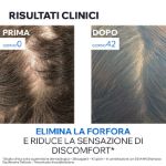 Uriage DS Hair Shampoo Anti-forfora 500ml