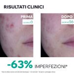Uriage Hyseac 3-regul+ Trattamento Globale anti-imperfezioni 40ml