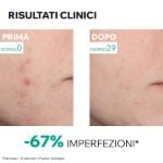 Uriage Hyseac Siero Booster Rinnovatore Anti-Imperfezioni 30ml